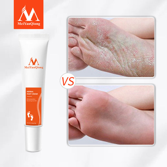 Cross-border cosmetics beauty Qiong foot cream aliexpress wish MYQ065